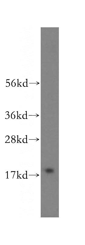 HeLa cells were subjected to SDS PAGE followed by western blot with Catalog No:117253(ZNHIT1 antibody) at dilution of 1:1000