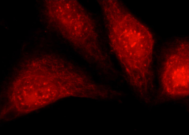 Immunofluorescent analysis of HepG2 cells using Catalog No:113770(PFKFB3 Antibody) at dilution of 1:50 and Rhodamine-Goat anti-Rabbit IgG