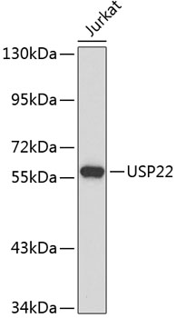 Western blot - USP22 Polyclonal Antibody 