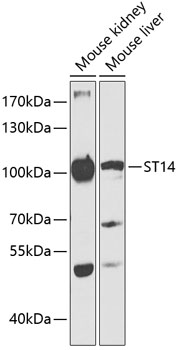 Western blot - ST14 Polyclonal Antibody 