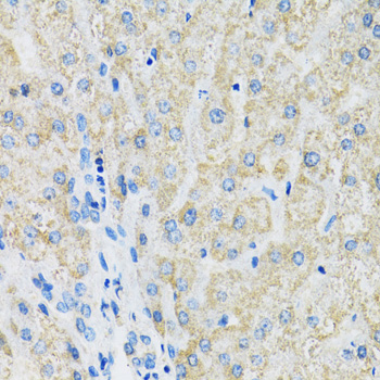 Immunohistochemistry - SLC19A1 Polyclonal Antibody 