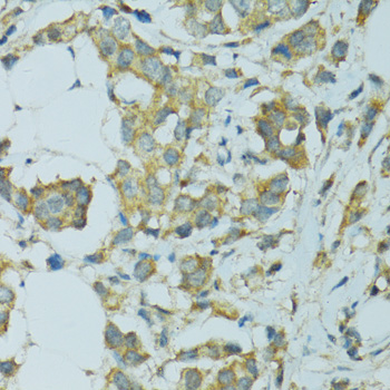Immunohistochemistry - CYP2B6 Polyclonal Antibody 