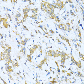 Immunohistochemistry - KLHL42 Polyclonal Antibody 