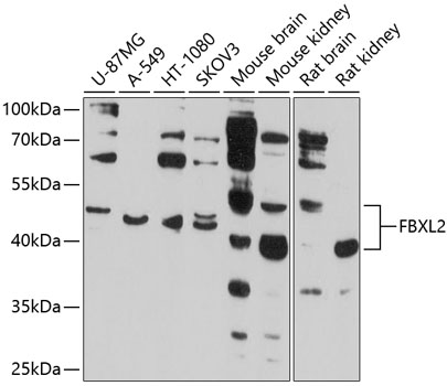 Western blot - FBXL2 Polyclonal Antibody 