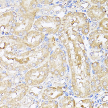 Immunohistochemistry - SAA3 Polyclonal Antibody 