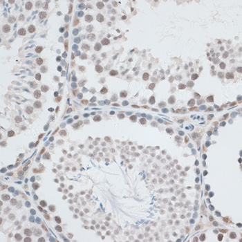 Immunohistochemistry - AQR Polyclonal Antibody 