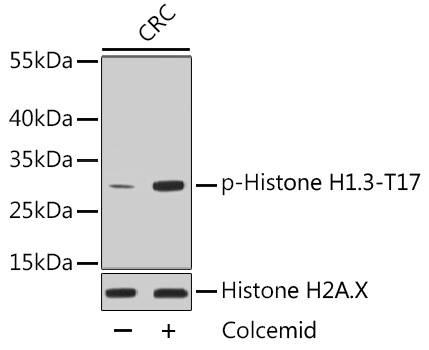 Western blot - Phospho-Histone H1.3-T17/Histone H1.4-T17 mAb 