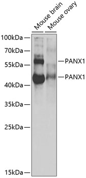 Western blot - PANX1 Polyclonal Antibody 