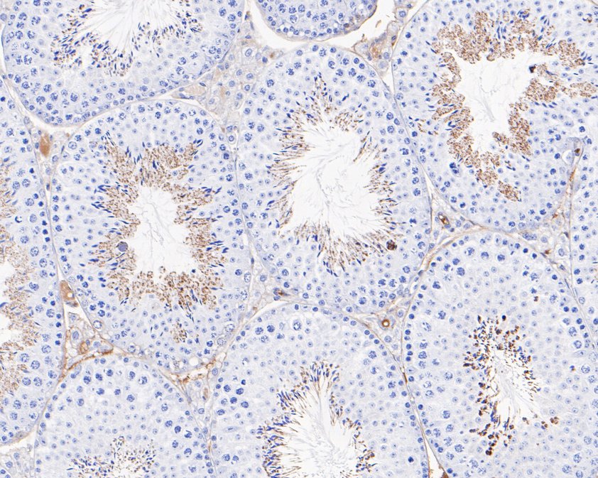 Fig2:; Immunohistochemical analysis of paraffin-embedded mouse testis tissue using anti-MC-2 antibody. The section was pre-treated using heat mediated antigen retrieval with Tris-EDTA buffer (pH 9.0) for 20 minutes.The tissues were blocked in 5% BSA for 30 minutes at room temperature, washed with ddH; 2; O and PBS, and then probed with the primary antibody ( 1/200) for 30 minutes at room temperature. The detection was performed using an HRP conjugated compact polymer system. DAB was used as the chromogen. Tissues were counterstained with hematoxylin and mounted with DPX.