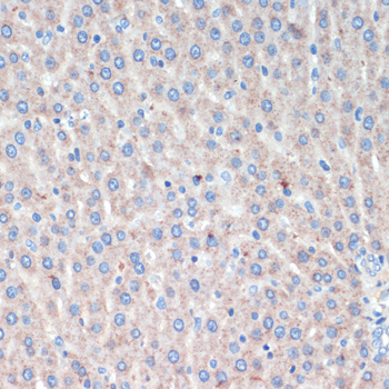Immunohistochemistry - LRRK2 Polyclonal Antibody 