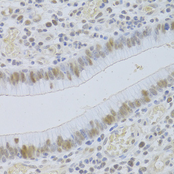 Immunohistochemistry - JMJD6 Polyclonal Antibody 