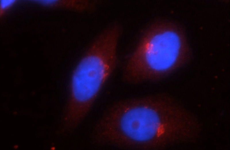 Immunofluorescent analysis of HeLa cells using Catalog No:108360(Barkor Antibody) at dilution of 1:25 and Rhodamine-Goat anti-Rabbit IgG