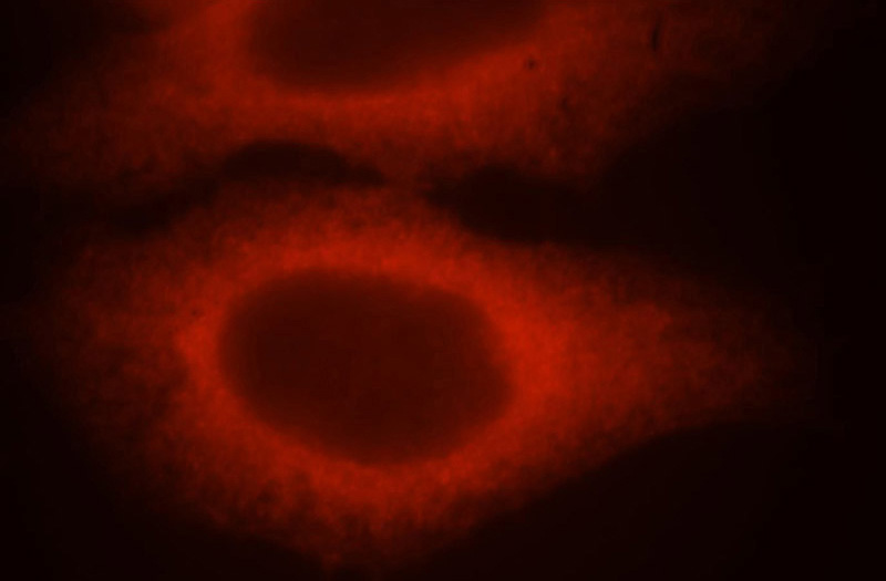 Immunofluorescent analysis of MCF-7 cells, using HSPB1 antibody Catalog No:111565 at 1:25 dilution and Rhodamine-labeled goat anti-rabbit IgG (red).