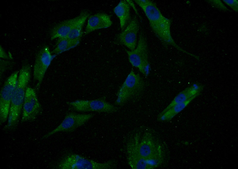 Immunofluorescent analysis of A375 cells using Catalog No:115542(SPANXE Antibody) at dilution of 1:50 and Alexa Fluor 488-congugated AffiniPure Goat Anti-Rabbit IgG(H+L)