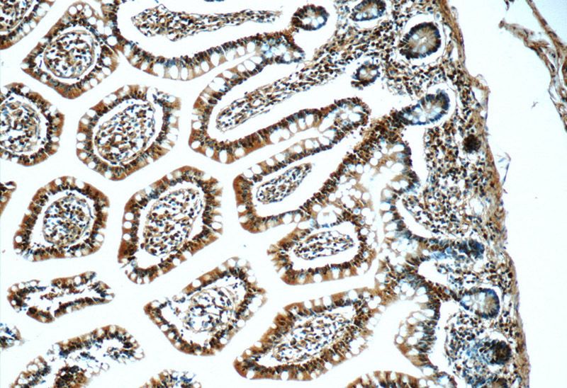Immunohistochemistry of paraffin-embedded human small intestine tissue slide using Catalog No:111505(hnRNP-E1 Antibody) at dilution of 1:50 (under 10x lens)