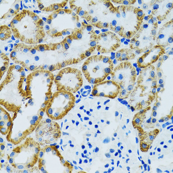 Immunohistochemistry - GDAP1 Polyclonal Antibody 