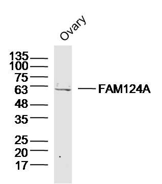 Fig2: Sample: Ovary (Mouse) Lysate at 40 ug; Primary: Anti-FAM124A at 1/300 dilution; Secondary: IRDye800CW Goat Anti-Rabbit IgG at 1/20000 dilution; Predicted band size: 60kD; Observed band size: 60kD