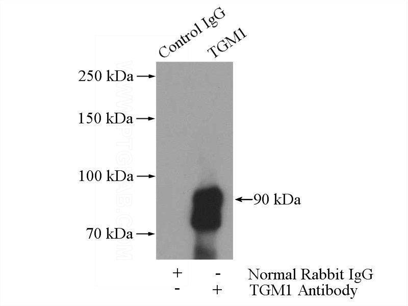 IP Result of anti-TGM1 (IP:Catalog No:116028, 4ug; Detection:Catalog No:116028 1:1000) with mouse kidney tissue lysate 4000ug.
