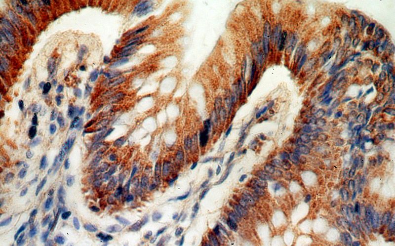 Immunohistochemical of paraffin-embedded human colon using Catalog No:113849(PRKCD antibody) at dilution of 1:100 (under 40x lens)