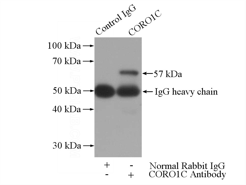 IP Result of anti-CORO1C (IP:Catalog No:109475, 4ug; Detection:Catalog No:109475 1:500) with mouse skeletal muscle tissue lysate 3600ug.