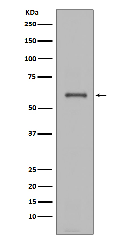 Western blot analysis of NOX4 expression in JAR cell lysate.