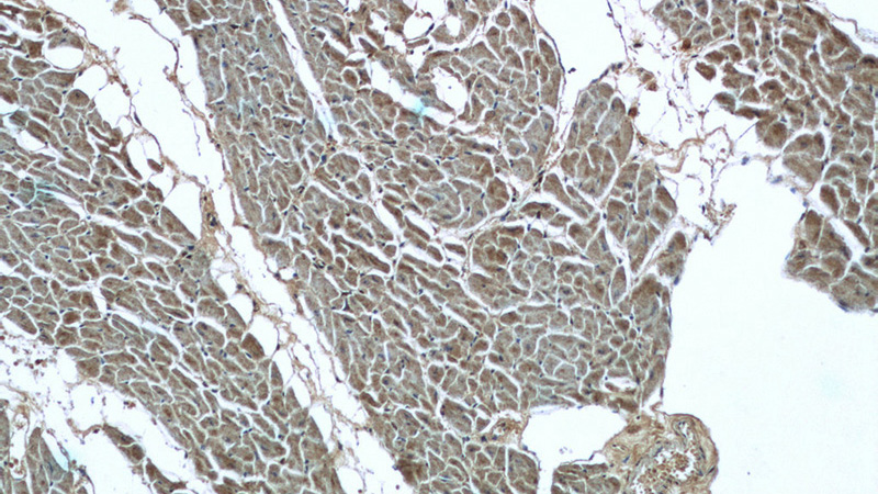 Immunohistochemistry of paraffin-embedded human heart tissue slide using Catalog No:112228(LIMK1 Antibody) at dilution of 1:200 (under 10x lens)