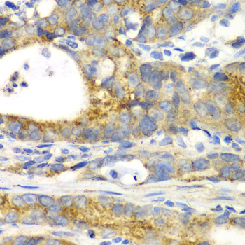 Immunohistochemistry - GORASP1 Polyclonal Antibody 