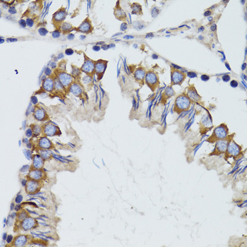 Immunohistochemistry - HEXA Polyclonal Antibody 