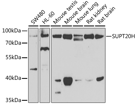 Western blot - SUPT20H Polyclonal Antibody 