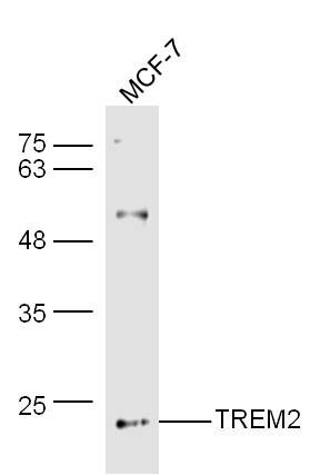Fig2: Sample:; MCF-7 Cell (Human) Lysate at 30 ug; Primary: Anti-TREM2 at 1/300 dilution; Secondary: IRDye800CW Goat Anti-Rabbit IgG at 1/20000 dilution; Predicted band size: 23 kD; Observed band size: 23 kD