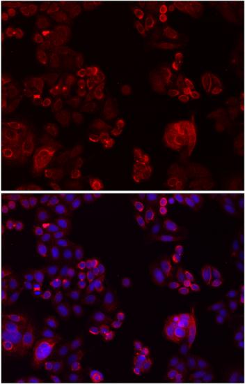 Immunofluorescence - NOTCH3 Polyclonal Antibody 