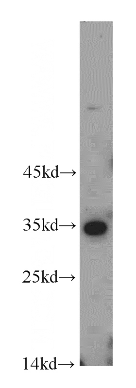 L02 cells were subjected to SDS PAGE followed by western blot with Catalog No:113980(PNO1 antibody) at dilution of 1:300