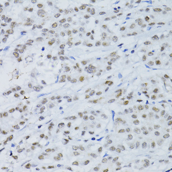 Immunohistochemistry - SNRNP70 Polyclonal Antibody 
