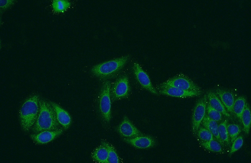 Immunofluorescent analysis of HepG2 cells using Catalog No:108339(ATP13A1 Antibody) at dilution of 1:50 and Alexa Fluor 488-congugated AffiniPure Goat Anti-Rabbit IgG(H+L)
