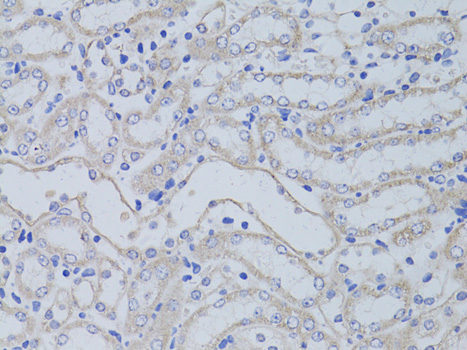 Immunohistochemistry - AQP5 Polyclonal Antibody 