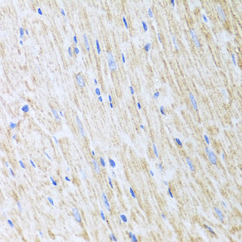 Immunohistochemistry - RCN2 Polyclonal Antibody 