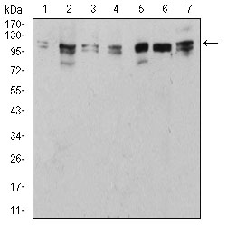 Fig3: Western blot analysis of ULK2 on different cell lysate using anti-ULK2 antibody at 1/1,000 dilution.; Positive control:; Lane 1: NIH/3T3; Lane 2: HepG2; Lane 3: SK-Hep-1; Lane 4: SK-OV-3; Lane 5: C6; Lane 6: PC-12; Lane 7: MCF-7