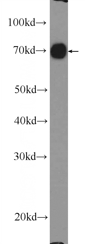 mouse liver tissue were subjected to SDS PAGE followed by western blot with Catalog No:114672(RDX Antibody) at dilution of 1:1000