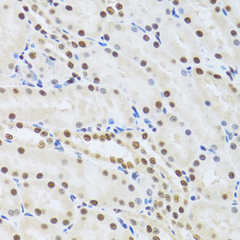 Immunohistochemistry - MTA3 Polyclonal Antibody 