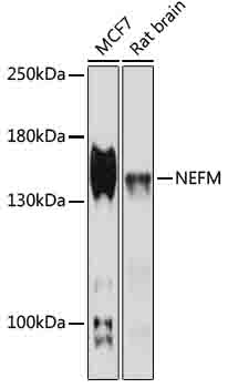 Western blot - NEFM Polyclonal Antibody 
