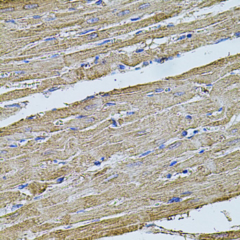 Immunohistochemistry - FLNB Polyclonal Antibody 