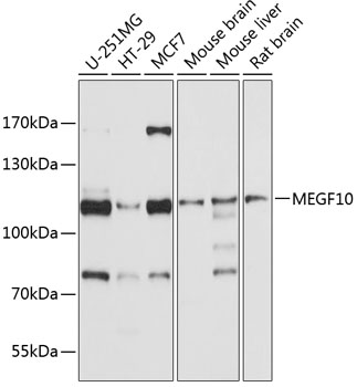 Western blot - MEGF10 Polyclonal Antibody 