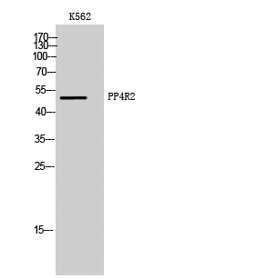 Fig1:; Western Blot analysis of K562 cells using PP4R2 Polyclonal Antibody