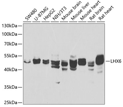 Western blot - LHX6 Polyclonal Antibody 