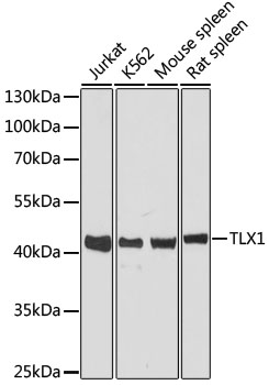 Western blot - TLX1 Polyclonal Antibody 
