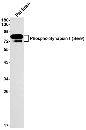 Western blot detection of Phospho-Synapsin I (Ser9) in Rat Brain cell using Phospho-Synapsin I (Ser9) Rabbit mAb(1:1000 diluted).Predicted band size:74kDa.