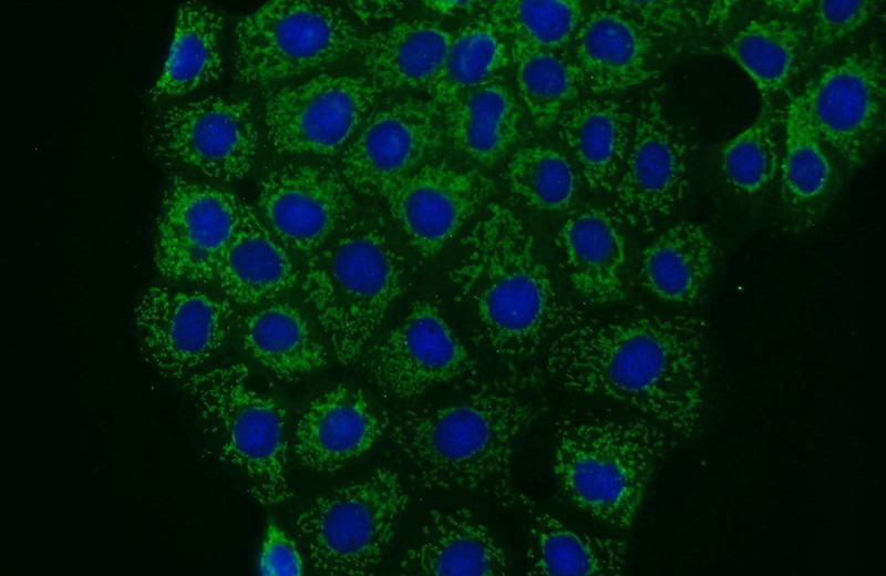 Immunofluorescent analysis of A431 cells using Catalog No:113799(PHACTR4 Antibody) at dilution of 1:50 and Alexa Fluor 488-congugated AffiniPure Goat Anti-Rabbit IgG(H+L)