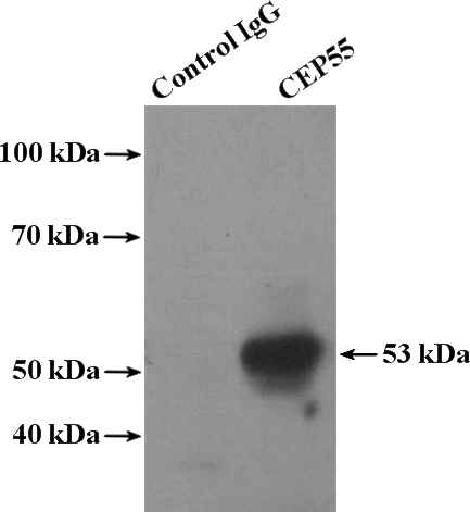 IP Result of anti-CEP55 (IP:Catalog No:109182, 4ug; Detection:Catalog No:109182 1:500) with mouse testis tissue lysate 4000ug.