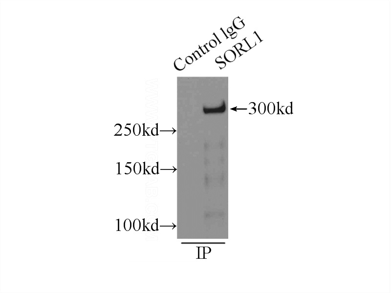 IP Result of anti-SORL1 (IP:Catalog No:115506, 5ug; Detection:Catalog No:115506 1:500) with mouse brain tissue lysate 10000ug.