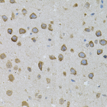 Immunohistochemistry - ASAH2 Polyclonal Antibody 